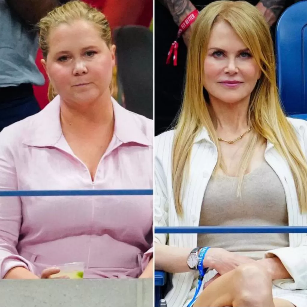 amy schumer slammed for bullying nicole kidman_png