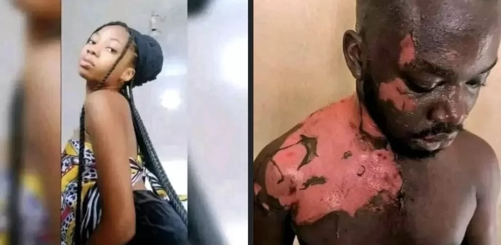 Unizik Female Student Baths Hostel President With Hot Water And Stabs Him