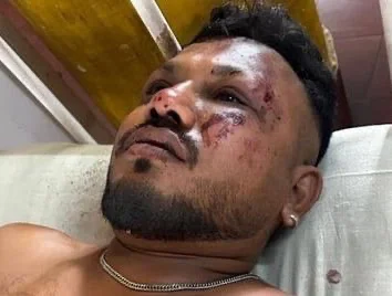 Sole Survivor Of Air India Plane Crash In Ahmedabad Miraculously Escapes With Minor Injuries